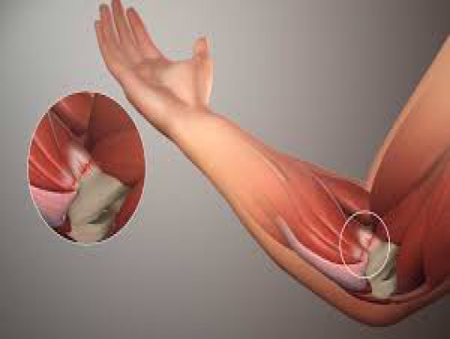 Đau khớp khuỷu tay: Nguyên nhân và cách xử trí